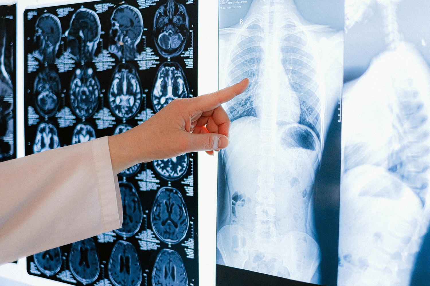 Muito além da imagem: quando o diagnóstico vê o que o corpo ainda não entende