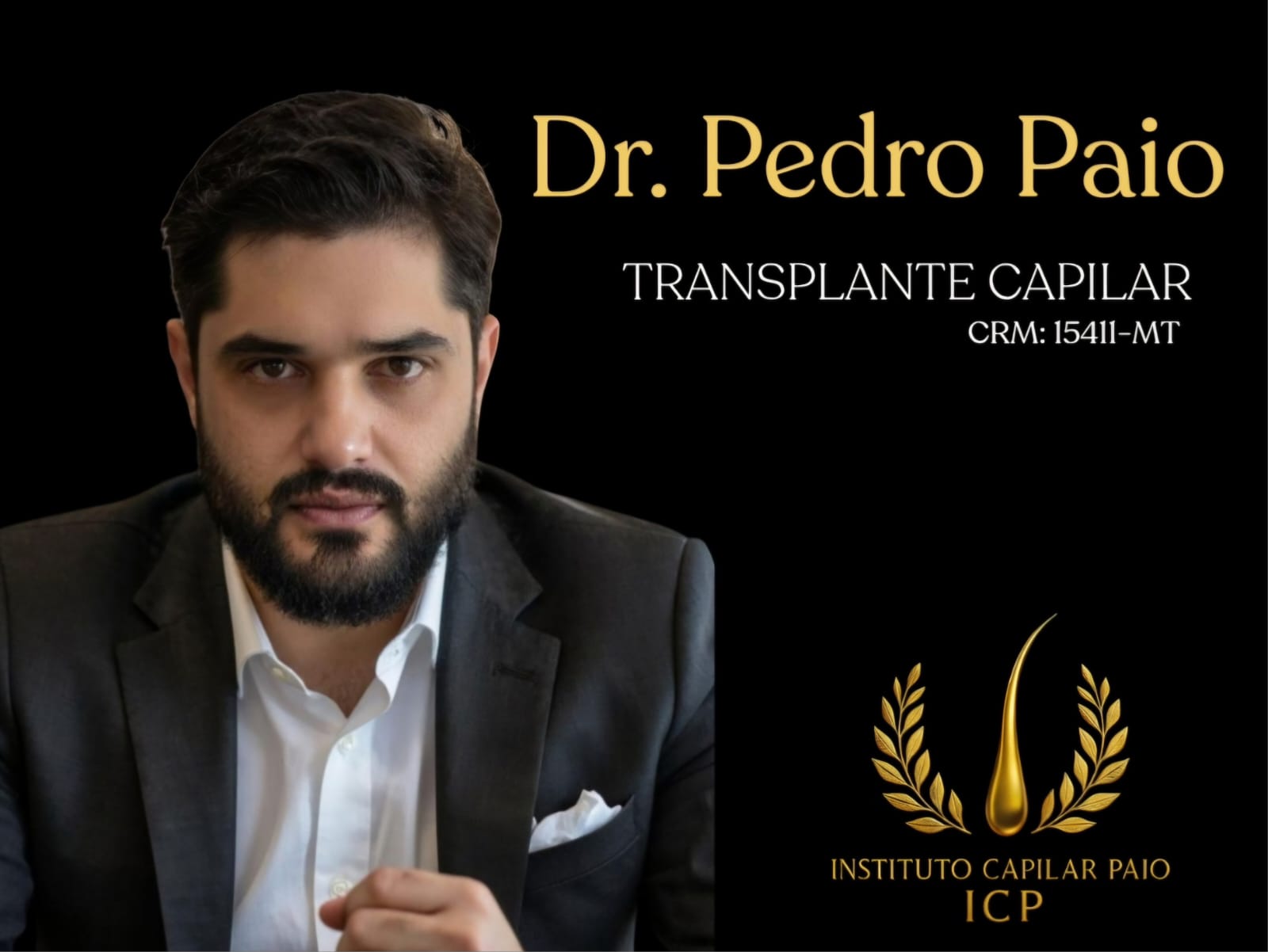“Perfurito Paio: técnica aperfeiçoada por médico brasileiro ganha destaque no transplante capilar moderno”