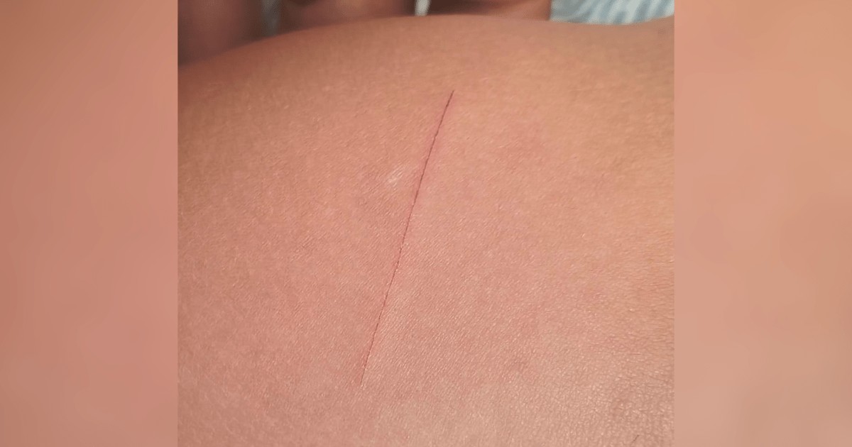 Criança é ferida na escola e passa por tratamento contra HIV em MG