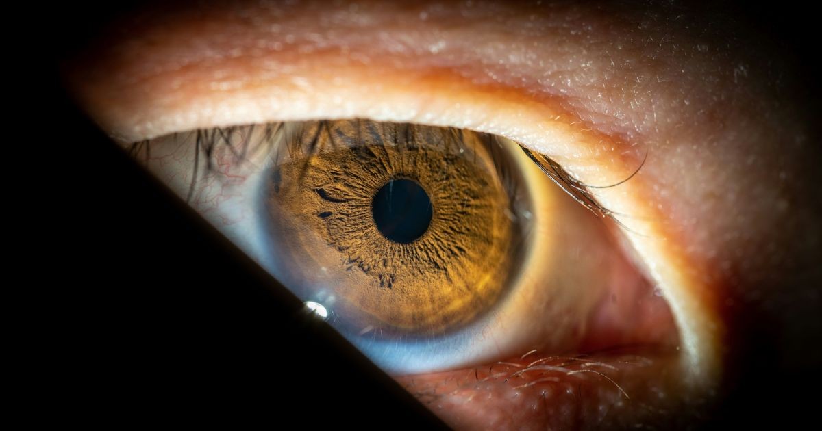 Cirurgia única para tratar glaucoma e catarata será oferecida pelo SUS