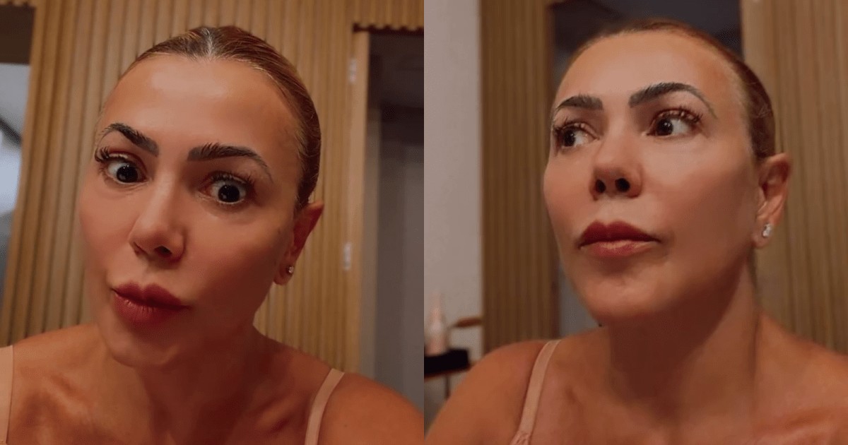 Ex-BBB fala sobre descoberta de cisto no cérebro: “Entrei em pânico”