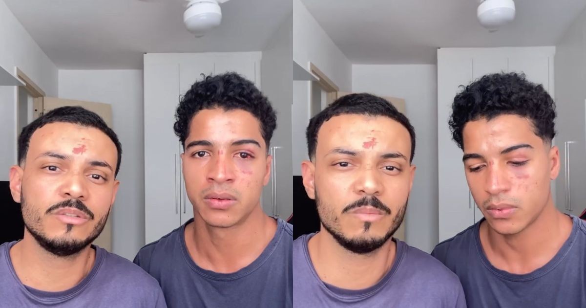 Jovens relatam ataque homofóbico após festa universitária no RJ