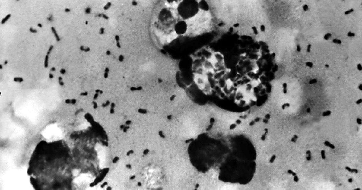 Rússia diz que nenhum caso de peste foi detectado após morte de cientista