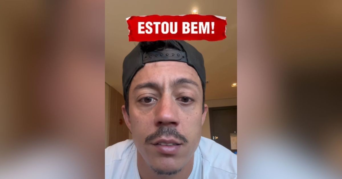 Paralisia de Bell: veja famosos que tiveram o quadro, além de Renato Albani