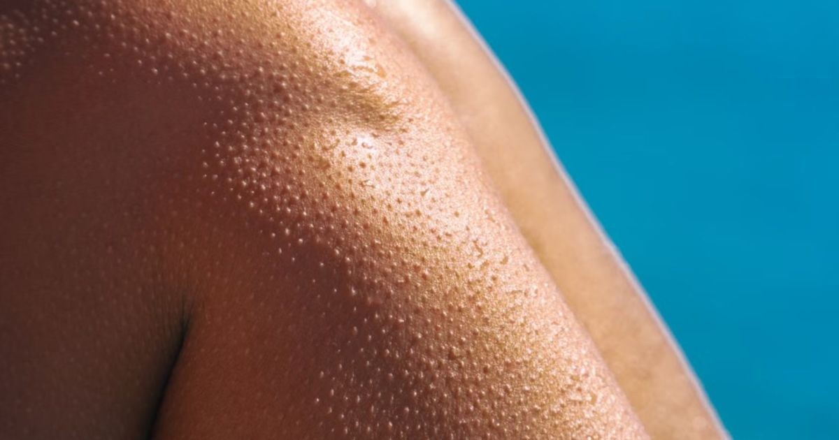 Por que a pele arrepia contra a nossa vontade? Entenda o reflexo ancestral que explica a reação