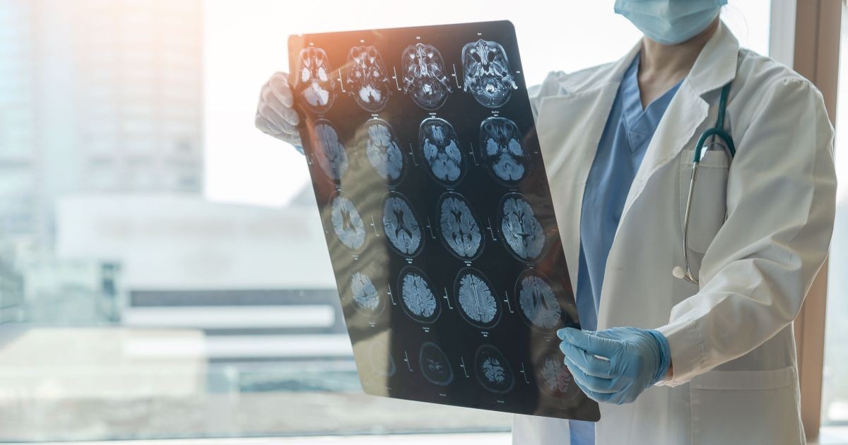 Seus hábitos podem aumentar o risco de AVC? Saiba como prevenir doença