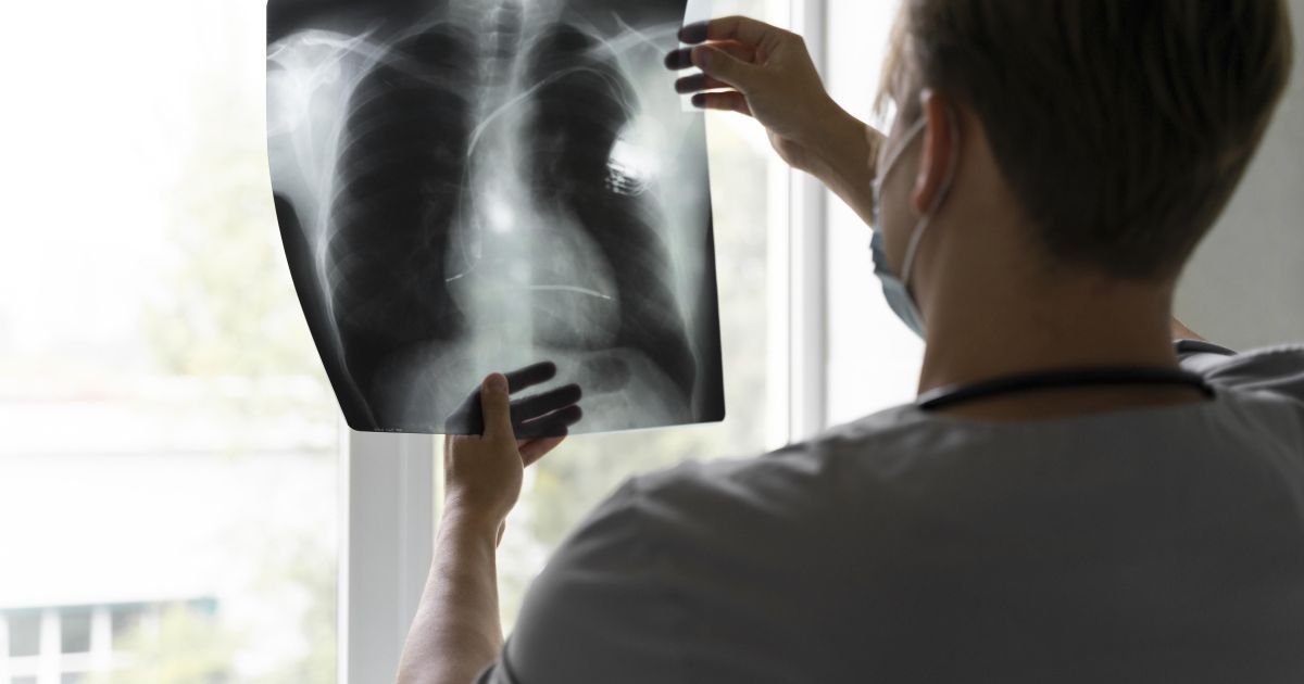 Câncer de pulmão: 1 a cada 5 pacientes não realizaram o teste genômico