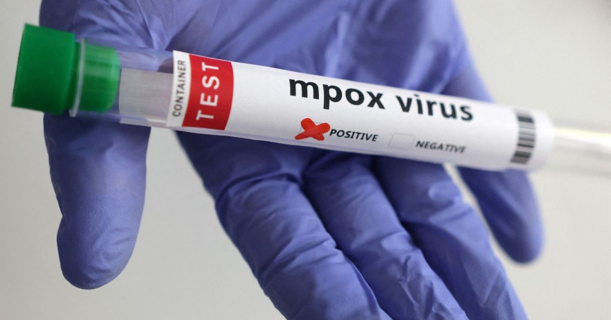 Rio de Janeiro registra 74 casos de Mpox em dois meses