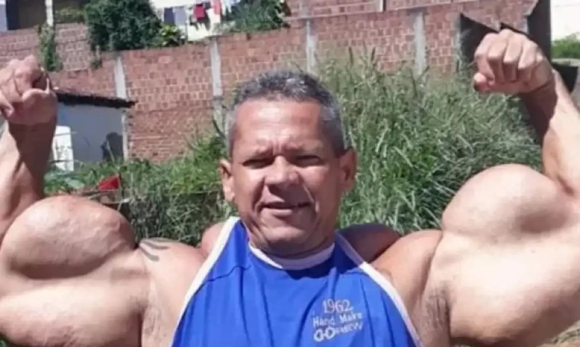Morre Arlindo de Souza, conhecido como \"Popeye Brasileiro\"