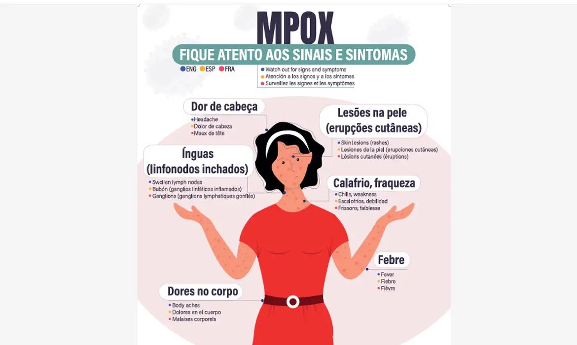Secretaria de Saúde confirma segundo caso de mpox do grupo lp em SP