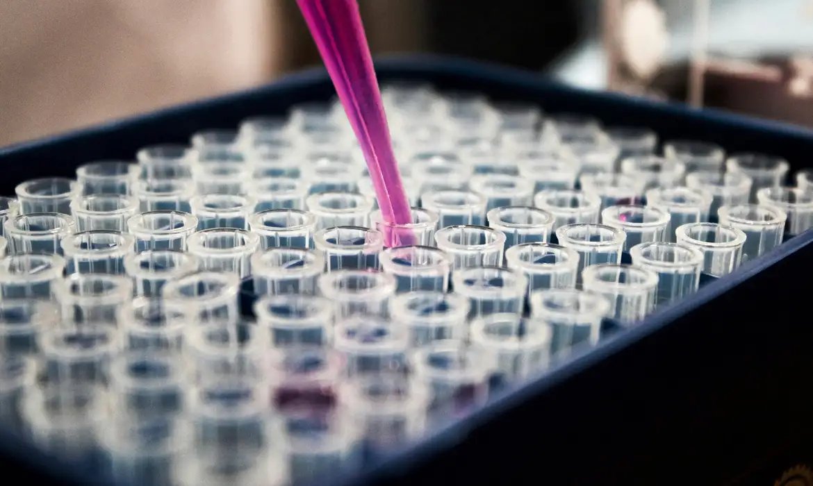 Estudo mostra que inflamação no cérebro pode ser chave do Alzheimer