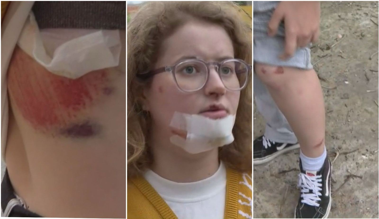 'Fiquei desesperada', diz jovem que despencou em bueiro após tampa de concreto ceder em Cuiabá