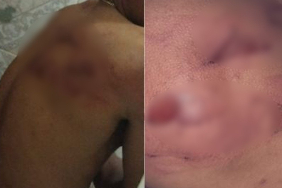 Trabalhadores denunciam patrões por agressões em alojamento de MT