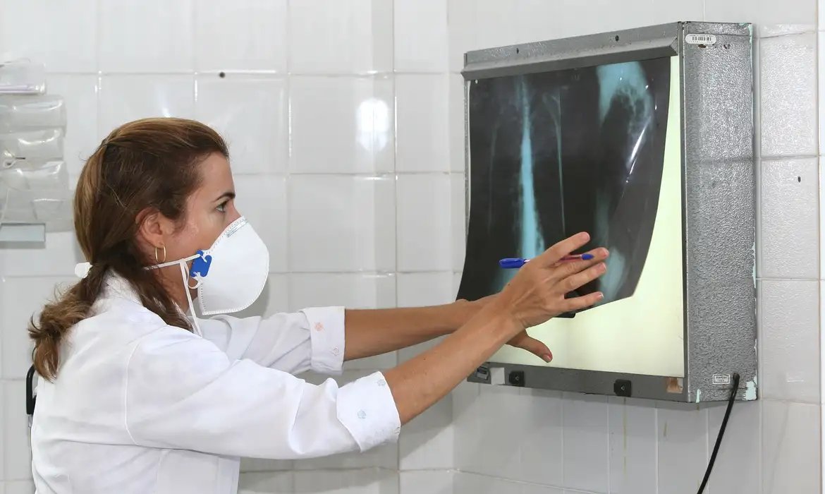 OMS recomenda testes de diagnóstico rápido para erradicar tuberculose