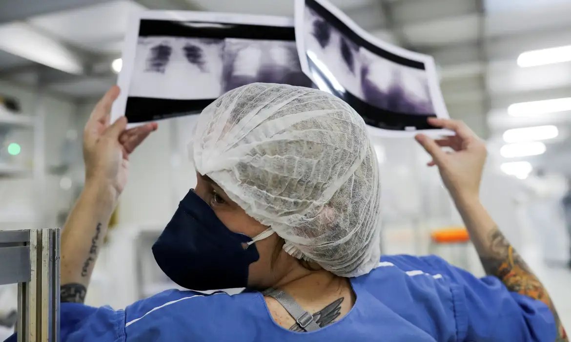 Diagnóstico tardio dá poucas chances de cura do câncer de pulmão 