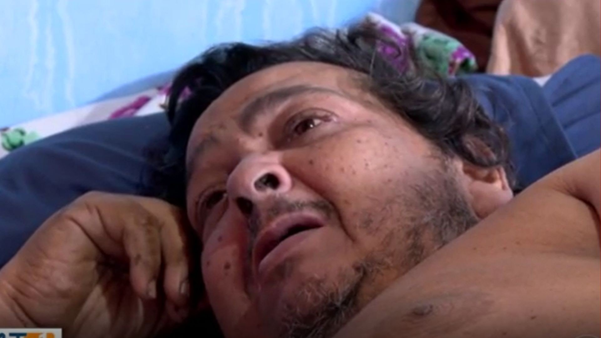 Mecânico de 230 kg é internado após 20 dias acamado em oficina sem atendimento
