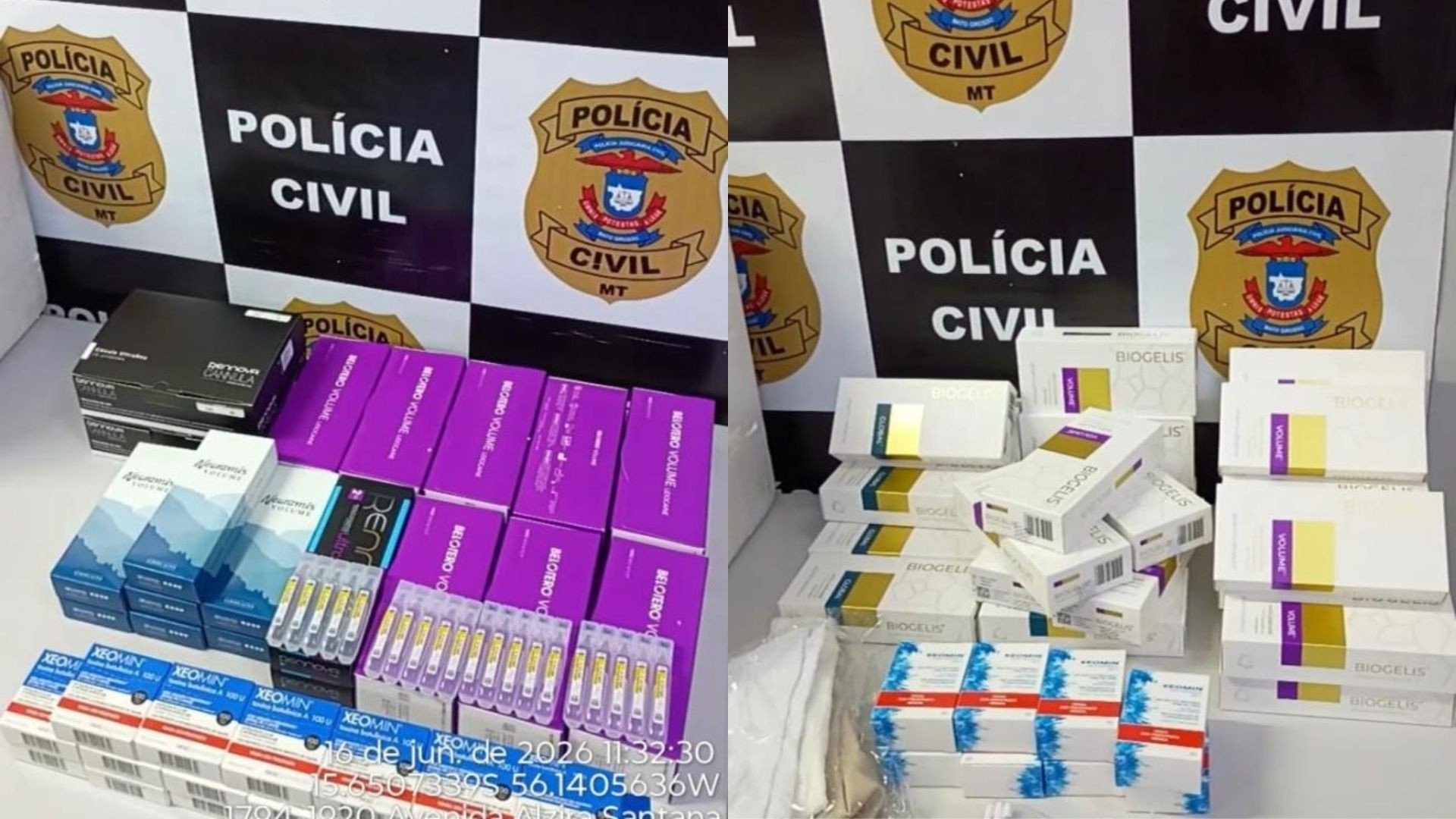 Casal é preso em flagrante com produtos de harmonização orofacial em MT