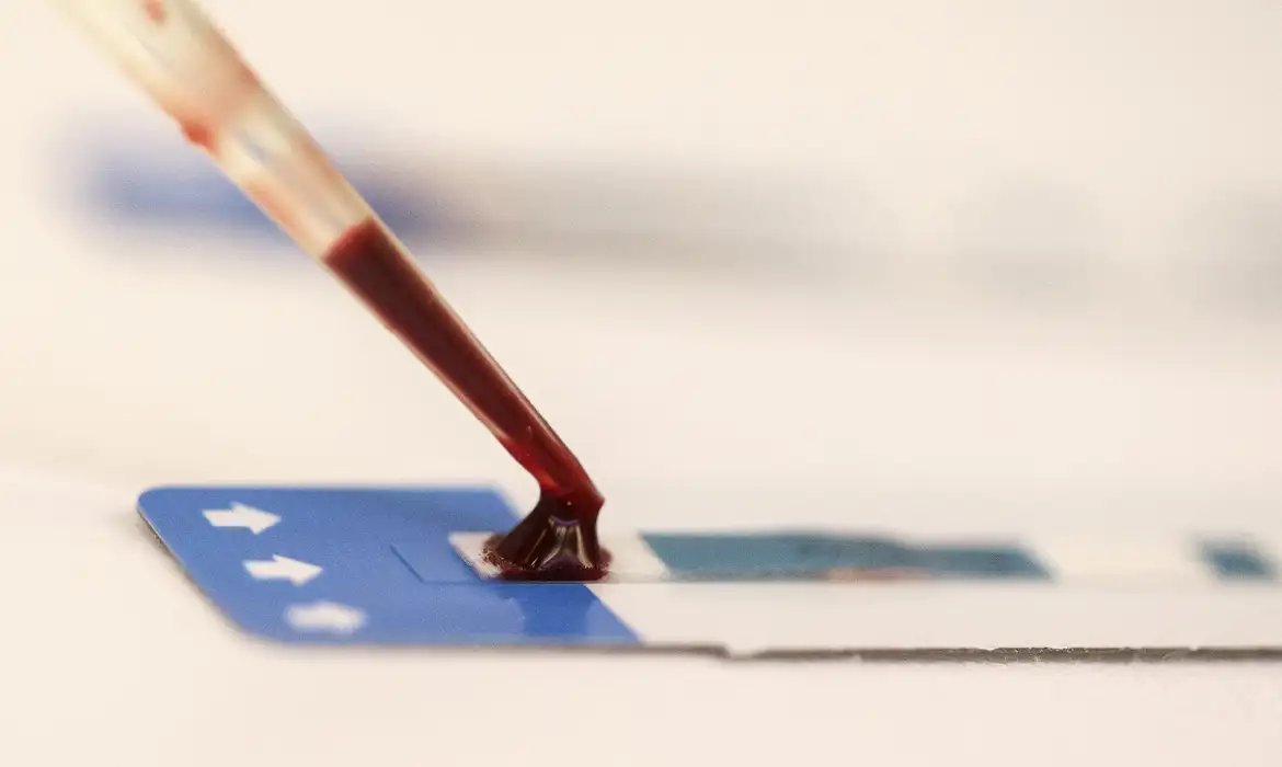 Estudo inédito da Fiocruz pode ampliar prevenção de HIV entre jovens 