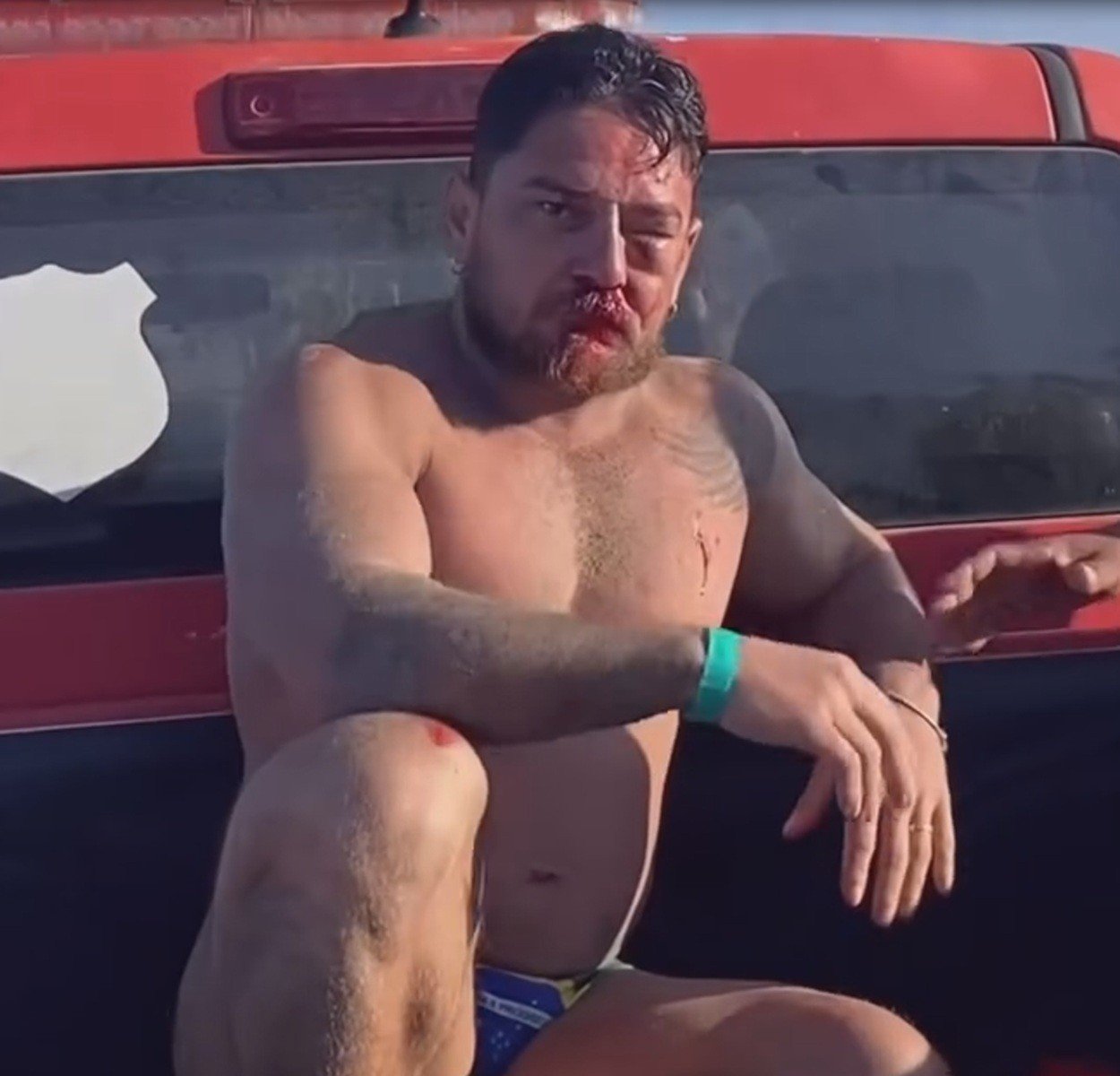 Casal de MT agredido em Porto de Galinhas tinha planejado comemorar aniversário na praia: 'sonho de infância'