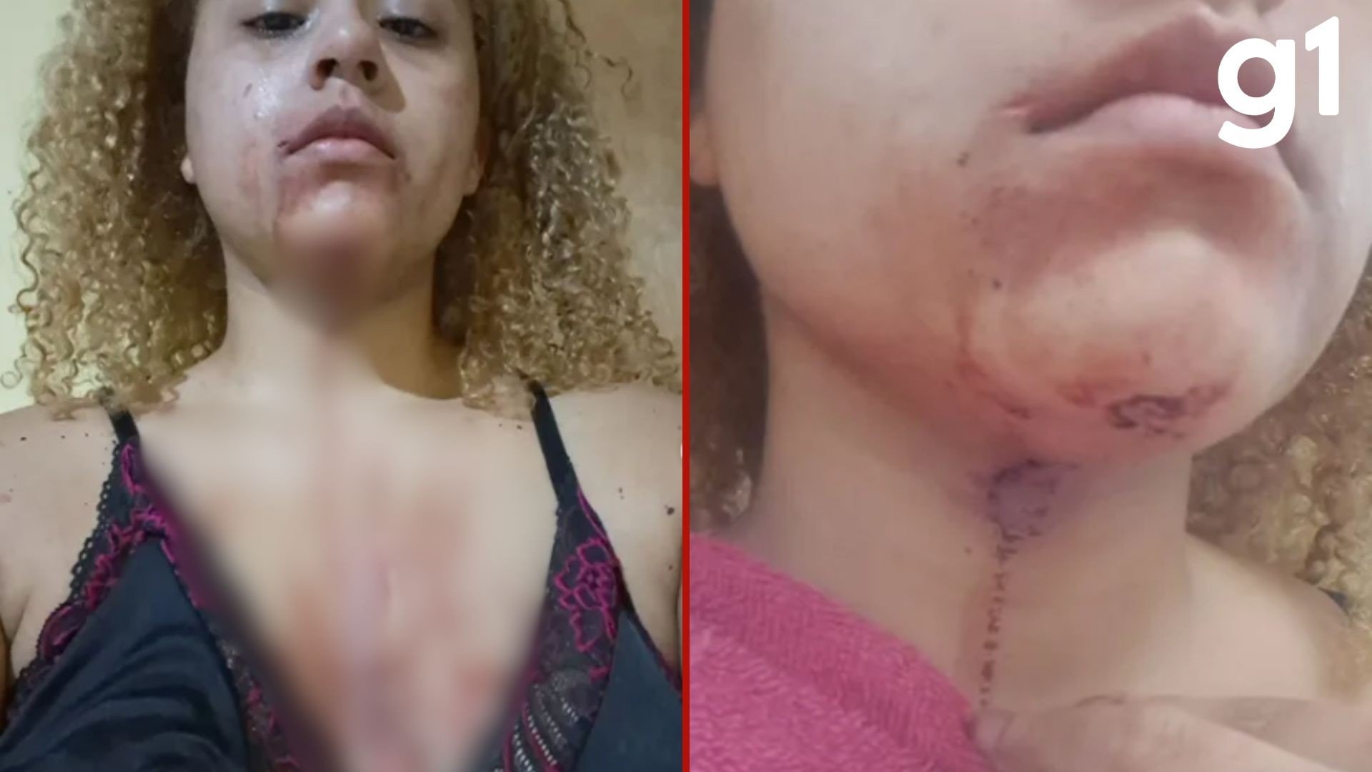 Estudante de Direito denuncia agressão e ameaça de policiais militares dentro de casa em Cuiabá