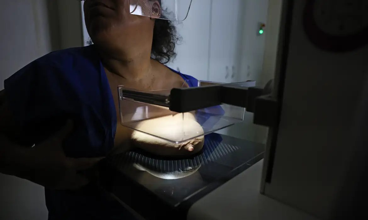 ANS defende que plano cubra mamografia digital sem restrição de idade