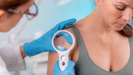Unimed Cuiabá reforça que forma de evitar o câncer de pele é se proteger do sol