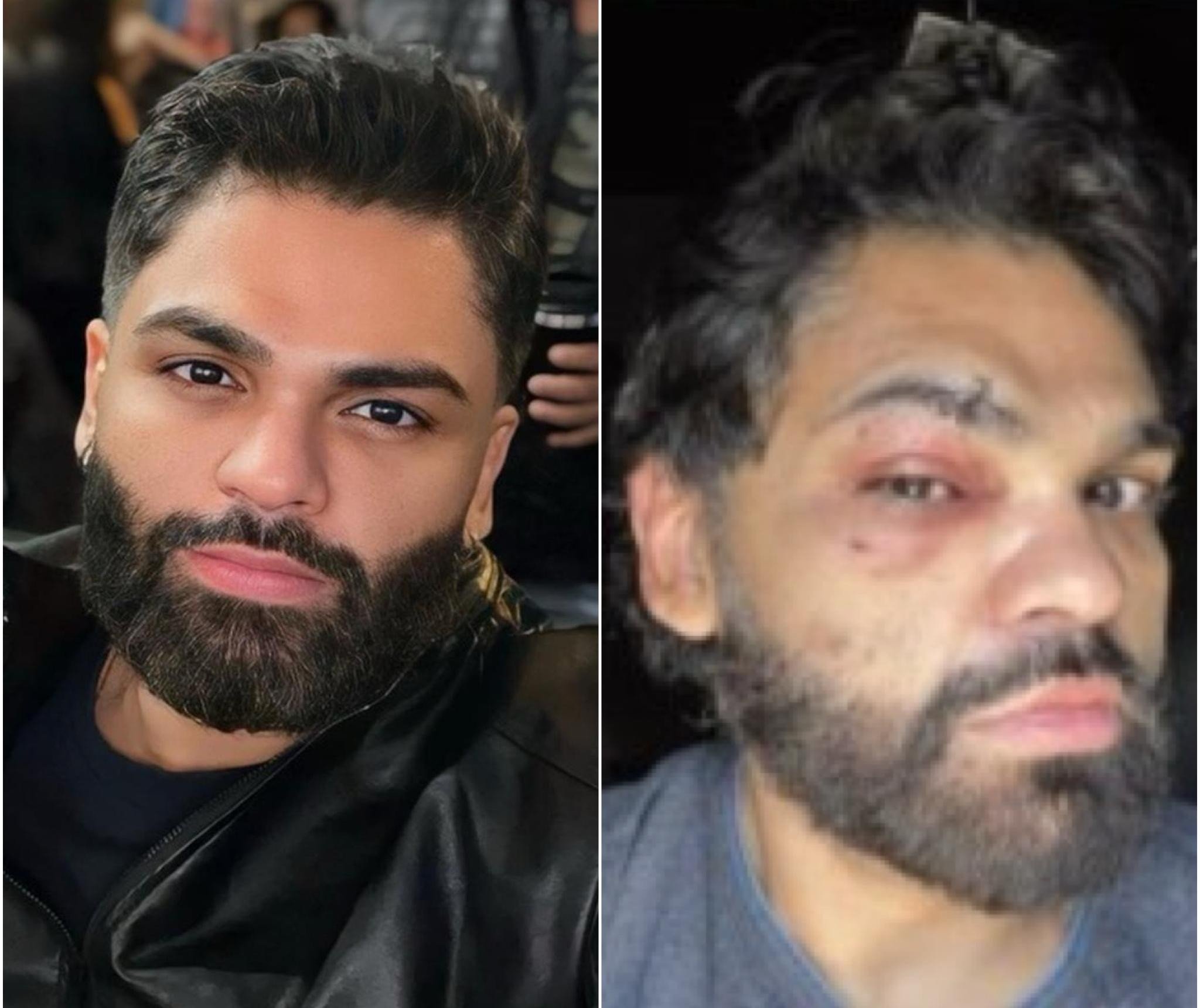 Justiça rejeita queixa-crime de psicólogo que denunciou homofobia após agressão em boate de Cuiabá