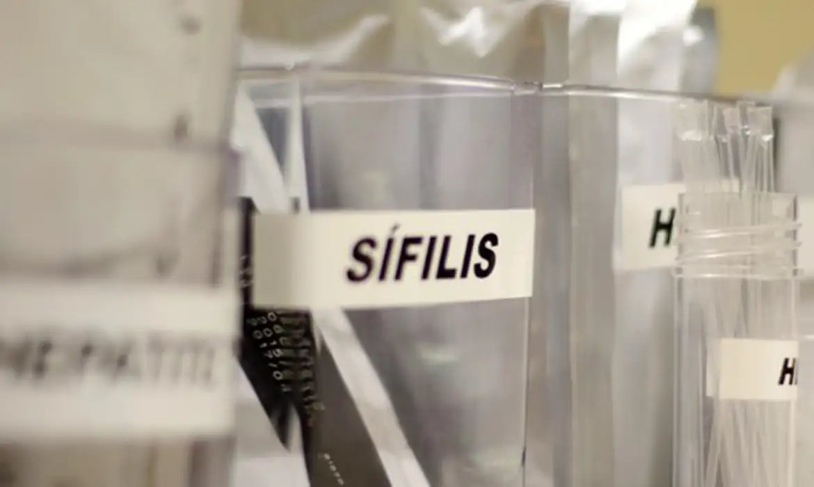 Centro de SP tem testagem grátis de HIV, hepatite, síflis e gonorreia