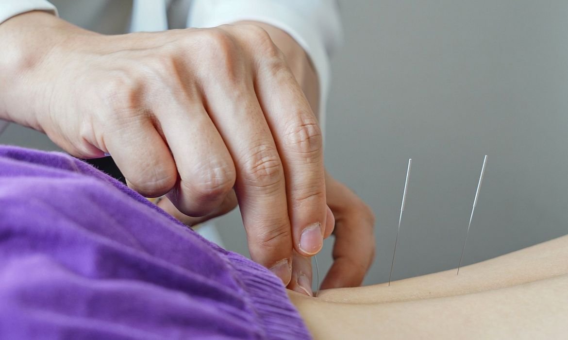 Brasil regulamenta exercício profissional da acupuntura